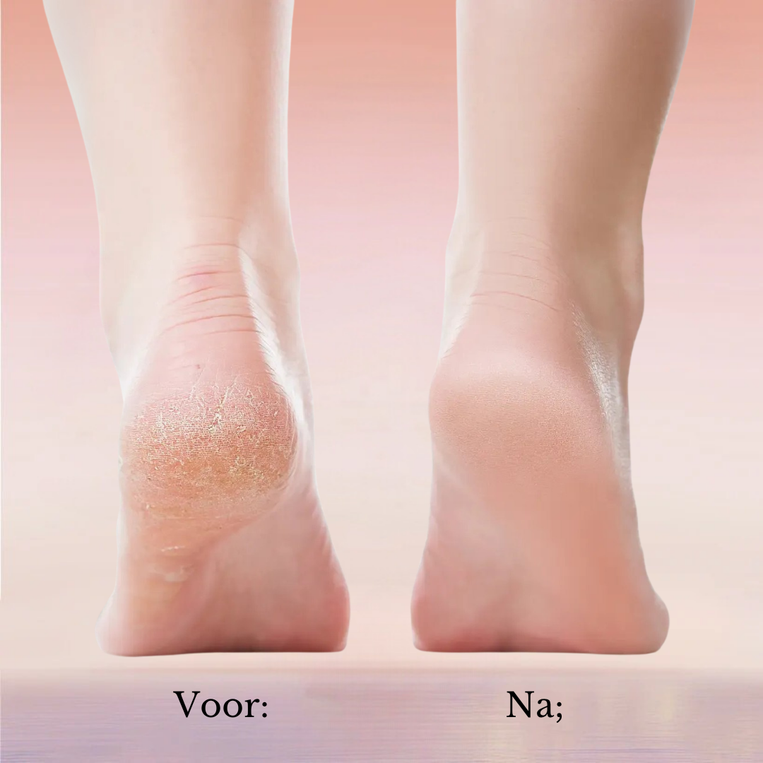 FootGlow 2.0 – Direct Zachte Voeten Vanuit Huis