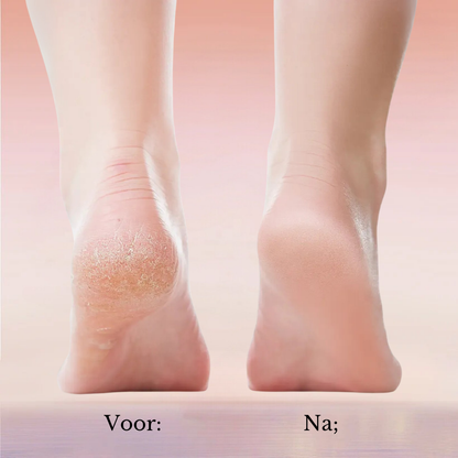 FootGlow 2.0 – Direct Zachte Voeten Vanuit Huis