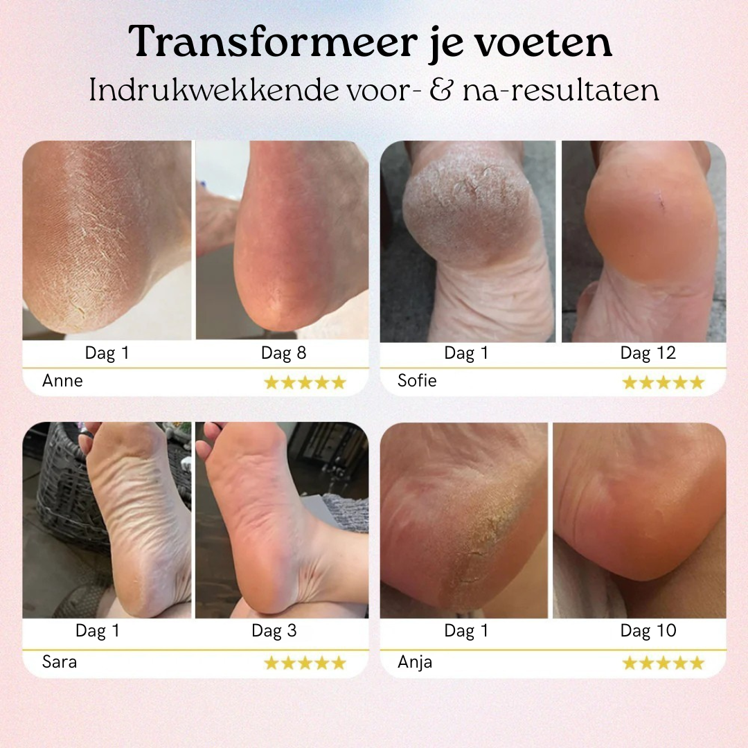 FootGlow 2.0 – Direct Zachte Voeten Vanuit Huis