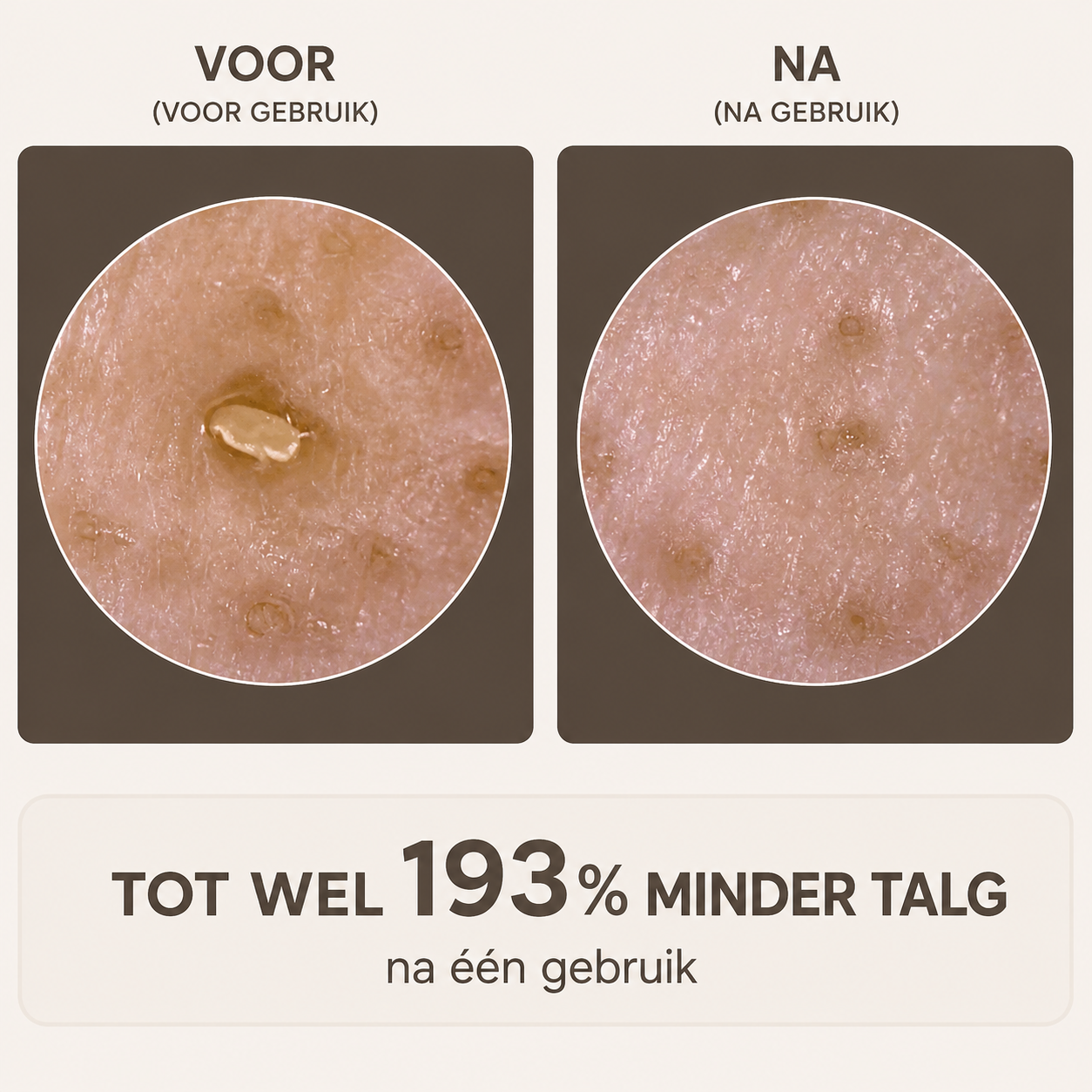 Peel Shot - Verwijdert onzuiverheden en laat uw huid stralen