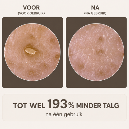 Peel Shot - Verwijdert onzuiverheden en laat uw huid stralen