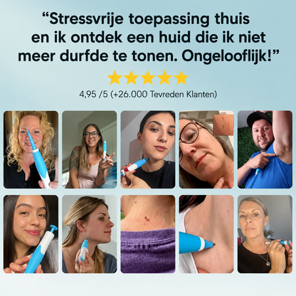 DermaSkin Pro™ - Vaarwel Huid Tags