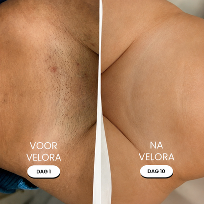 Trimmer 5-1 | Velora