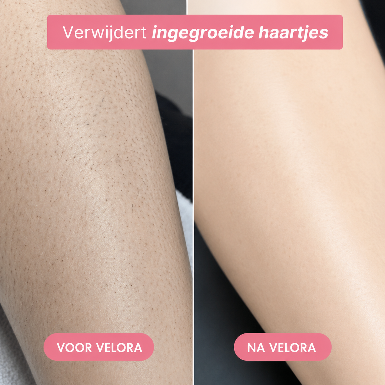 Trimmer 5-1 | Velora
