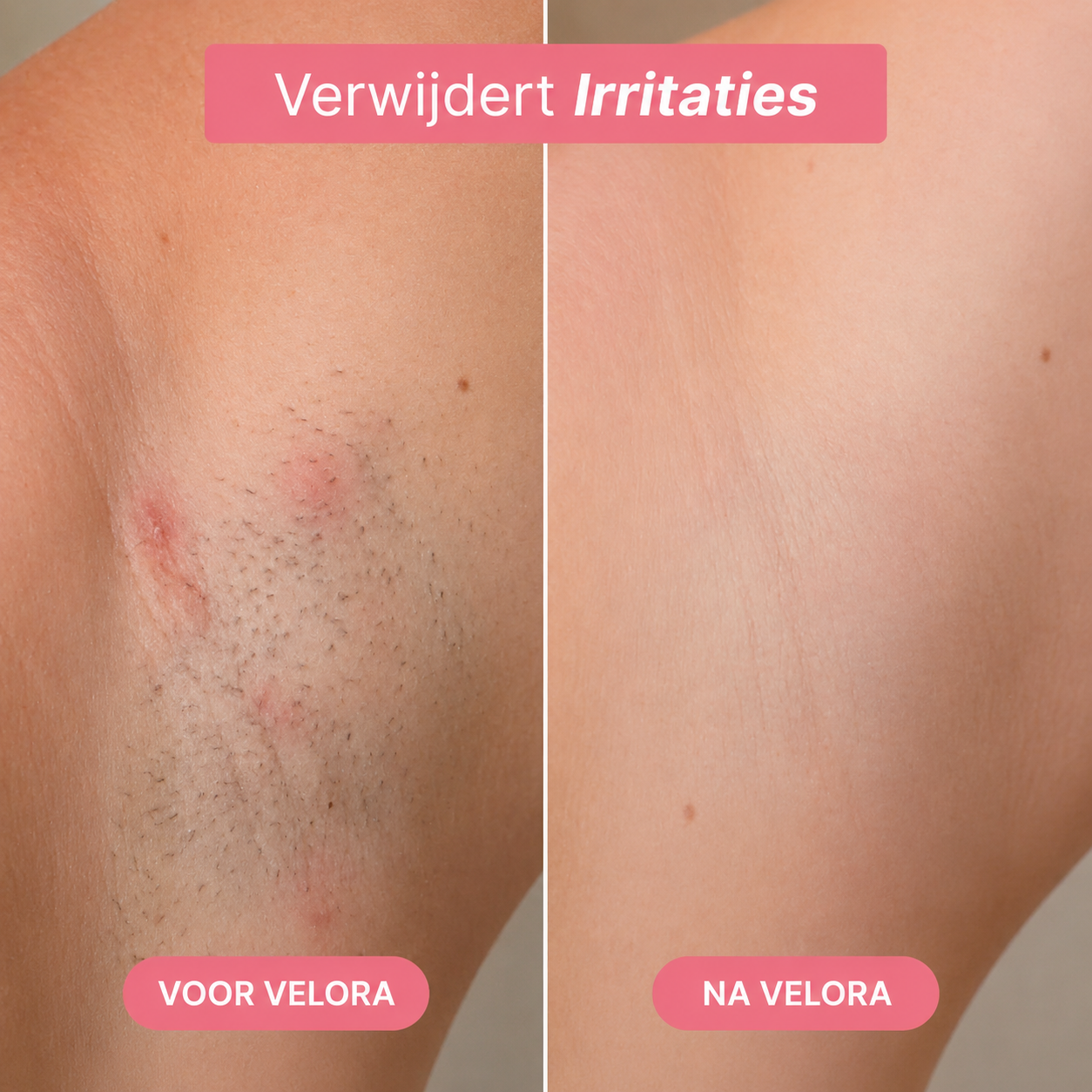 Trimmer 5-1 | Velora