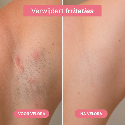 Trimmer 5-1 | Velora