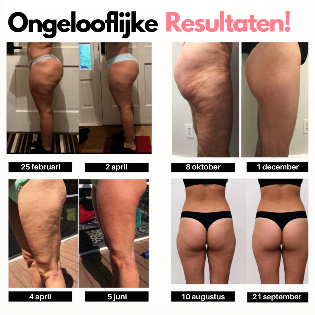 Legging 3D-Anti Cellulite